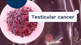 testicular cancer  What it is symptoms causes and treatment [upl. by Balcke]