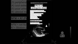 Effects of cardiogenic shock [upl. by Cassius591]