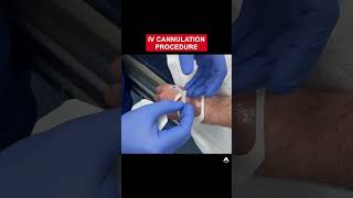 IV Cannulation Procedure  shorts ivcannulation anesthesiology nurse [upl. by Nyleuqcaj]