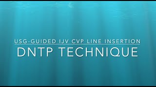 CVP line Insertion using DNTP technique Ultrasound guided central line insertion [upl. by Allin]