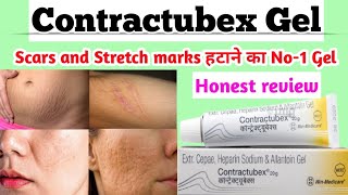 Contractubex Gel। contractubex gel uses in hindi। acne scars removal gel। get relief scars quickly। [upl. by Oilenroc469]