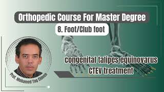 Clubfoot congenital talipes equinovarus CTEV treatment  Foot Orthopedic course د محمد تاج الدين [upl. by Evers434]