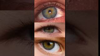 Central Heterochromia Debunked 👁️ [upl. by Ecirtnahc87]