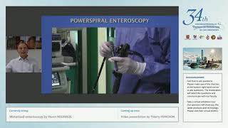 Motorized Enteroscopy by Horst NEUHAUS [upl. by Kajdan]