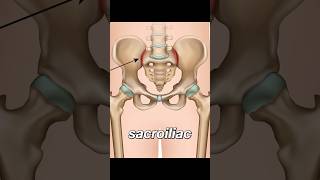 Sacroiliitis  lower back pain [upl. by Konstanze879]