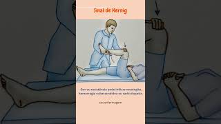 Sinal de Kernig semiologia neuroscience saude enfermagem medicina fisioterapia [upl. by Hillell16]