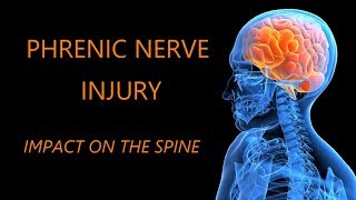 PHRENIC NERVE INJURY IMPACT ON THE SPINE MedEd UHN kyphosis [upl. by Theone]