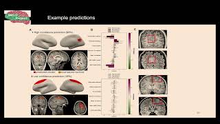 OHBM 2024  Educational Course  Precision surface imaging of the cerebral cortex  Part 10 [upl. by Linnette206]