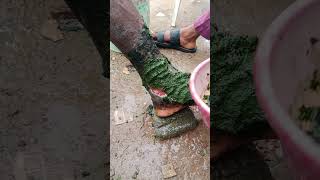 Elephantiasis Treatment [upl. by Carley]