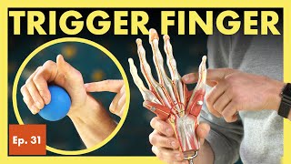 What is Trigger Finger and How Do I Fix It Stenosing Tenosynovitis [upl. by Lleral733]