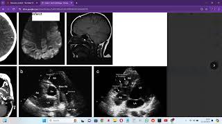 RADIOLOGY EXAM CASES [upl. by Felecia7]