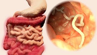 Nematode Navigations A Dive into Gastrointestinal Parasites 4 Minutes [upl. by Korwun]