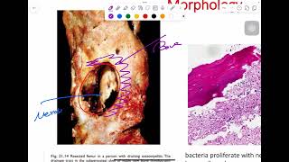 MSS pathology lab 2  part 1 [upl. by Georgeanna]