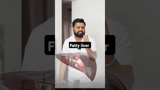 Fatty liver घर के खाने की ताकत को पहचानो drrobin health food ayurved doctor facts remedy [upl. by Ermanno]