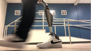 Hip disarticulation prosthetic gait demonstration 2022 [upl. by Greggory412]