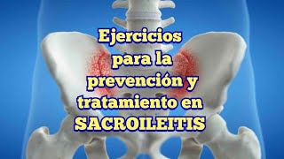 Ejercicios para PREVENCIÓN Y TRATAMIENTO SACROILEITIS [upl. by Mayap]