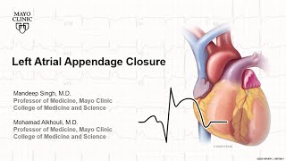 Left Atrial Appendage Closure [upl. by Louanne192]