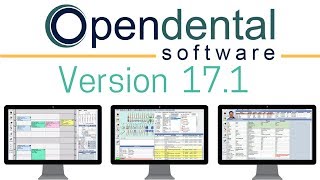 Open Dental Version 171  Highlights and Features [upl. by Creath]