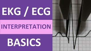 EKGECG Interpretation Basics Nursing NCLEX  QRS Complex P Wave T Wave PR Interval [upl. by Namlaz429]