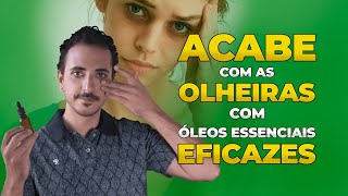 ACABE COM AS OLHEIRAS COM ÓLEOS ESSENCIAIS EFICAZES [upl. by Notnef]