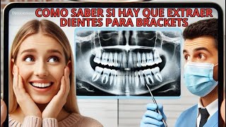 ¿Extracciones O NO Diagnosticando en Vivo Si Se Requieren Extracciones Para Este Paciente [upl. by Animas326]