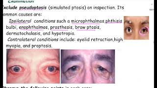 Ptosis lectureComprehensive Ophthalmology lecture A K Khurana [upl. by Akilat674]