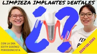 LIMPIEZA DE IMPLANTES DENTALES 🦷 con Dra Edith Godínez Padilla [upl. by Eatnuahs]