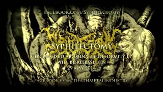 SYPHILECTOMY  Abnormality Through Purulent Sputum Official Video Stream [upl. by Shiroma]