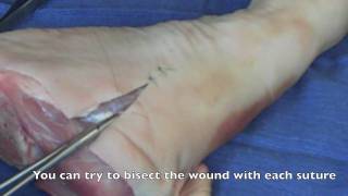 Suture  Basic Technique 2 [upl. by Michael]