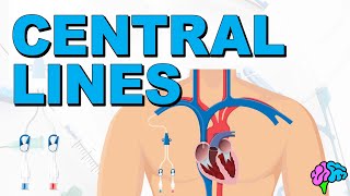 The Basics of Central Lines  Central Venous Catheters CVC [upl. by Lurleen860]