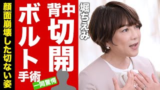 【衝撃】堀ちえみがquot背中切開quotしてquotボルト埋込手術quotの真相…顔面崩壊した切ない姿がヤバすぎた！『リ・ボ・ン』がヒットした女性歌手の再婚夫が会社をクビになった原因…息子2人と音信不通の理由に驚愕【芸能】 [upl. by Jammal]