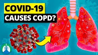 Can COVID19 Cause COPD [upl. by Haelem]