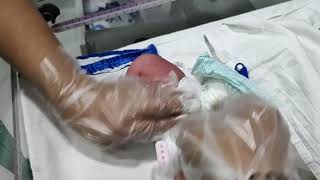 How to change nappy of a newborn girl [upl. by Trever]