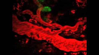 NIDCR Vascular Flow Close to a Lymph Node in a Live Mouse Harboring a Metastatic Tumor [upl. by Gertie]