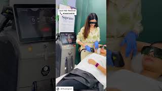 Laser Hair Removal for underarms at Tira Clinic Rohtak laser laserhairremoval hairremoval [upl. by Yettie229]