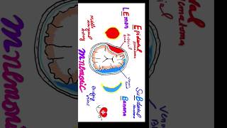 Mnemonic for Extradural hematoma vs Subdural hematoma for USMLE PLAB FCPS Medicine shorts viral [upl. by Rratsal]