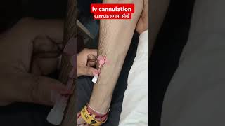 Iv cannula shorts trending viralvideos video iv injection drxsachinsaini12 [upl. by Bannerman540]