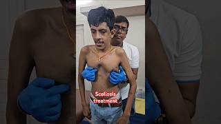 Scoliosis treatment drrajneeshkant worldfamouschiropractor [upl. by Greenburg]