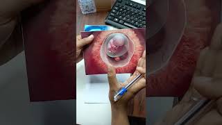 Yolk Sac Development In Pregnancy In Urdu  Hindi [upl. by Eladnar]