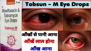 Moxifloxacin and tobramycin eye drops  Moxifloxacin amp tobramycin ophthalmic solution [upl. by Enileqcaj]