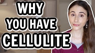 WHY YOU HAVE CELLULITE amp HOW TO GET RID OF IT  Dermatologist DrDrayzday [upl. by Nettle]