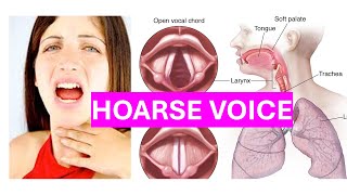 Hoarse Voice খোন শিবা [upl. by Aninnaig]