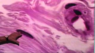 HISTOLOGIA RAZONADA tejido conectivo parte 2 [upl. by Sivehc]