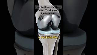 How to Bend the Knee after Total Knee Replacement [upl. by Salomie636]