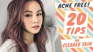 How to GET RID of ACNE  20 TIPS to Get CLEAR SKIN [upl. by Tuttle]