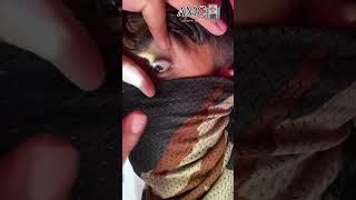 Anisocoria EYE 👁️ Medical points 🤔 आप भी चेक कर लो armymedical viralvideo [upl. by Saba]