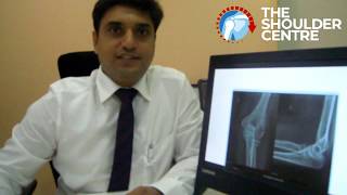 How to Send a Picture of Your XRay to A Doctor  Dr Harshad Jawalkar [upl. by Epoh]