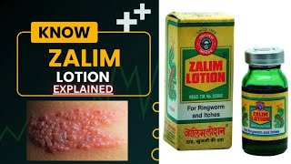 Zalim Lotion Uses Explained In Hindi  Zalim Lotion – The Solution for Skin Relief  Himalaya [upl. by Arretak870]