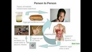 Cysticercosis and Neurocysticercosis Whos At Risk [upl. by Nasus]