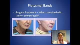 How Can I Soften the Look of my Neck  Platysmal Bands Consultation  Dr Anthony Youn [upl. by Denyse122]